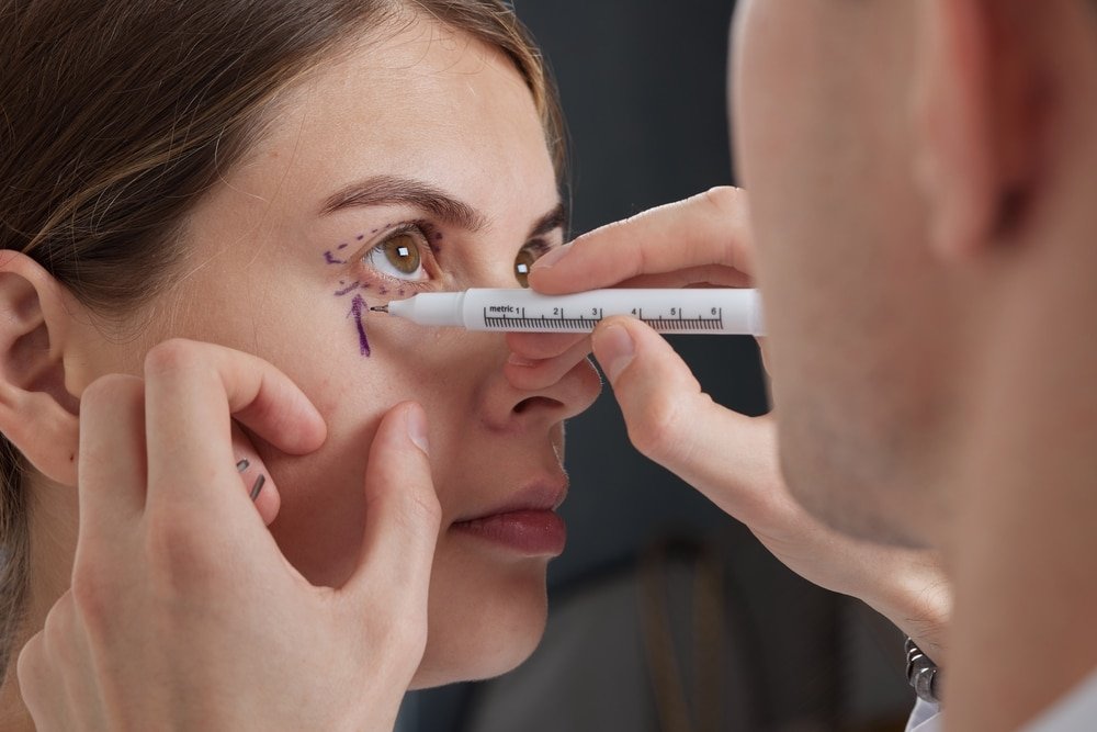 Patient demonstrating improved eyelid symmetry